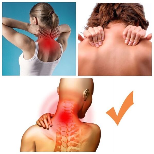 symptomen van cervicale osteochondrose