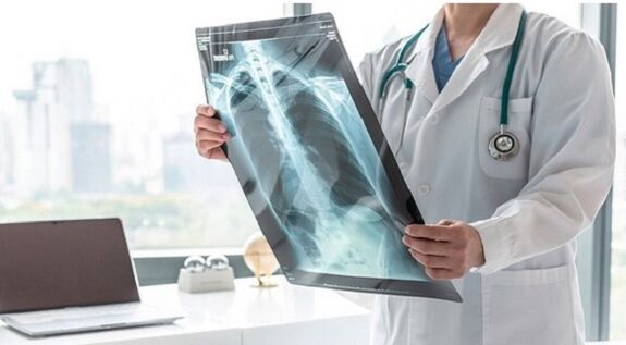 Röntgendiagnostiek voor pijn onder het linkerschouderblad