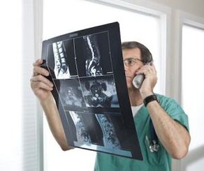 Myelografie voor de diagnose van osteochondrose en hernia's tussen de wervels