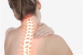 Cervicale osteochondrose bij een vrouw